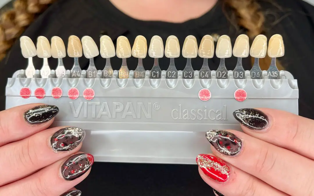 How Professional Teeth Whitening Works at Dr. Daia’s Office