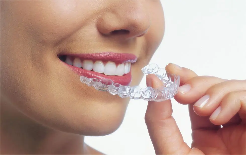 Woman putting in clear aligner