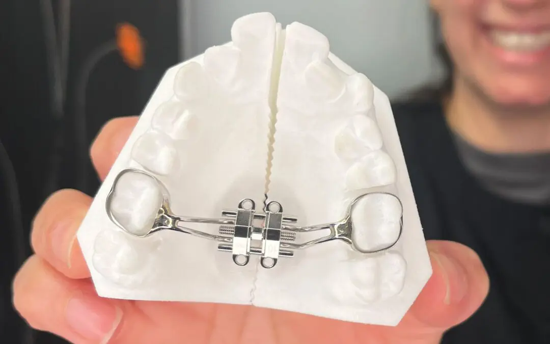 The Importance of Interceptive Orthodontics