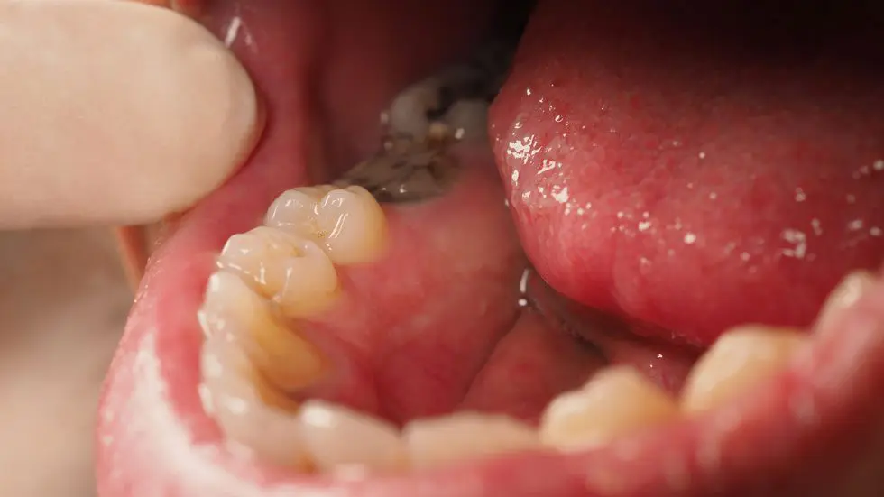 How Poor Oral Health Can Affect Numerous Parts of Your Life and Can Be Linked to More Problematic Health Conditions