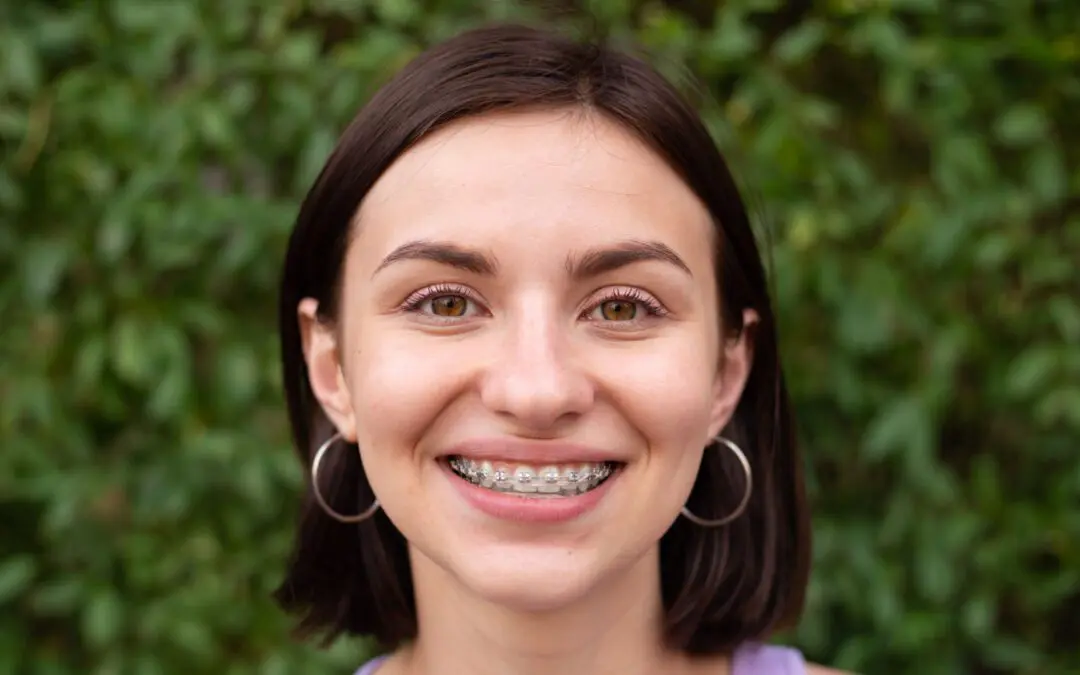 Comprehensive Orthodontics and How to Maintain New Braces