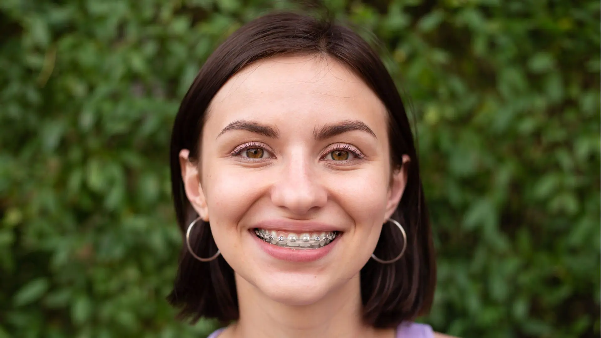 How to maintain new braces