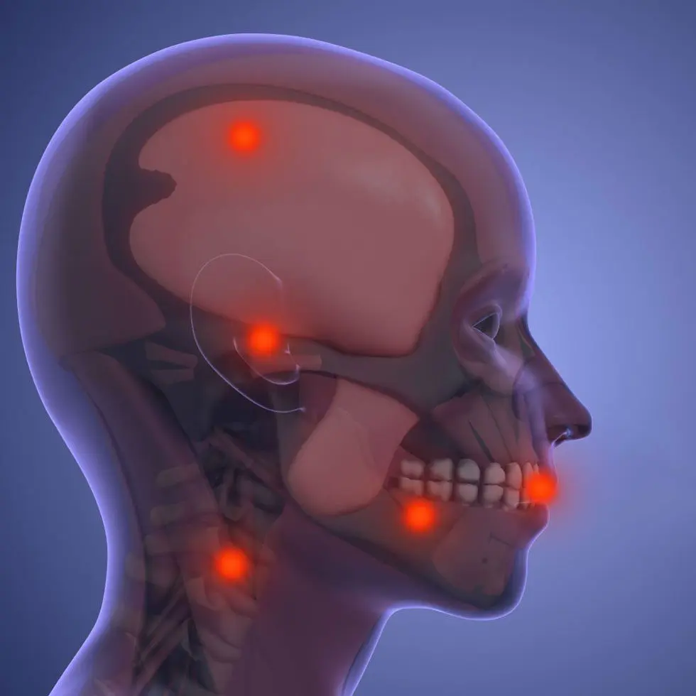 Jaw pain post-accident | Post-accident TMJ evaluation at Daia Orthodontics