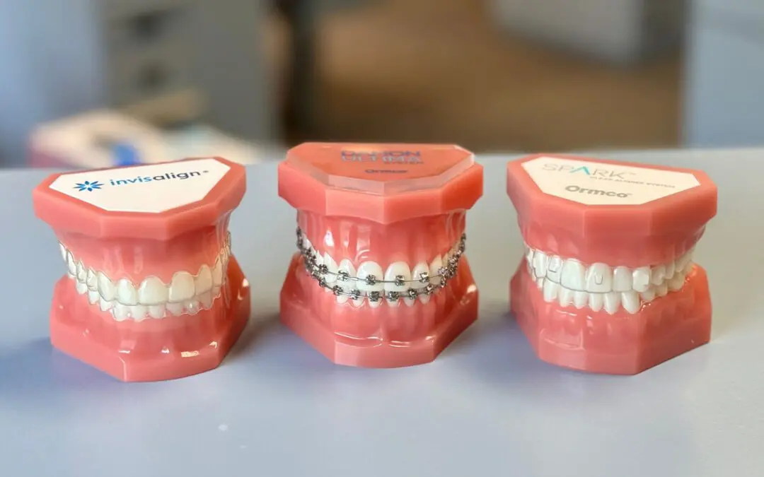 Braces vs. Clear Aligners: Which Is Right for You?