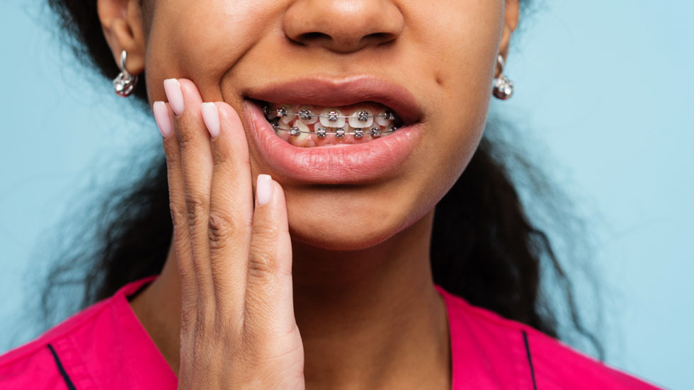 If you have issues with a broken wire or a loose bracket, see your orthodontist immediately