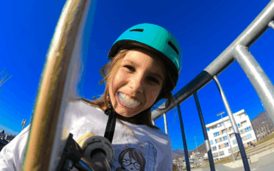 Why Mouthguards Matter in Sports: Before, During & After Braces